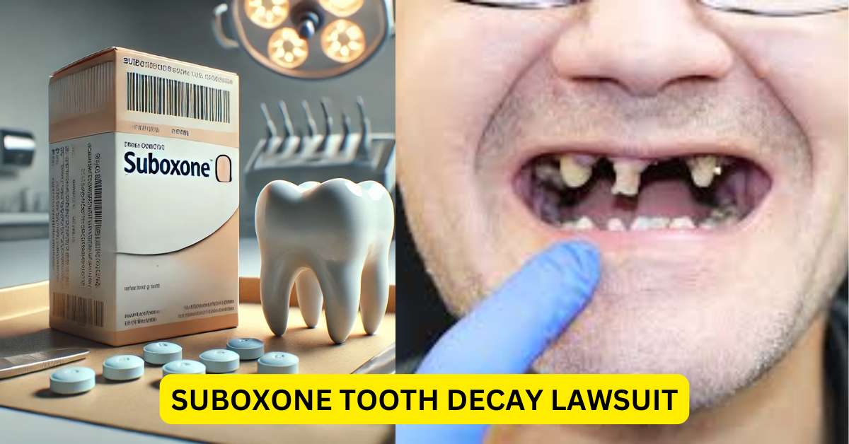 Suboxone Tooth Decay Lawsuit